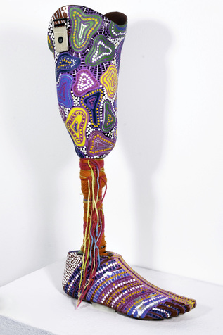 A prosthetic leg painted in brightly colored dots and wrapped in yarn