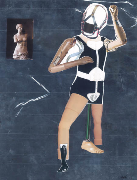 A collage of a figure with a face harness, prosthetic arms, legs, and feet next to a small image of the Venus de Milo, a marble statue of a woman with no lower arms.
